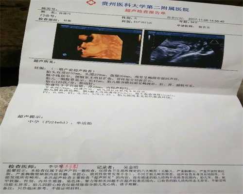 深圳代孕产子价格,谣言流产后要间隔半年再怀孕