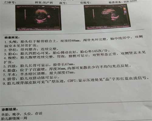 信阳代生一次多少钱：郑州治妇科病的医院哪家