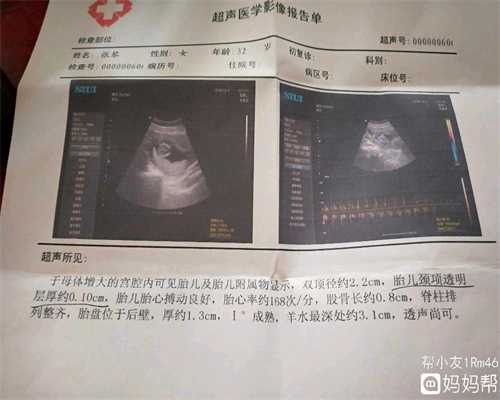 有找代孕的吗-和美助孕中心-36周出生的孩子算早