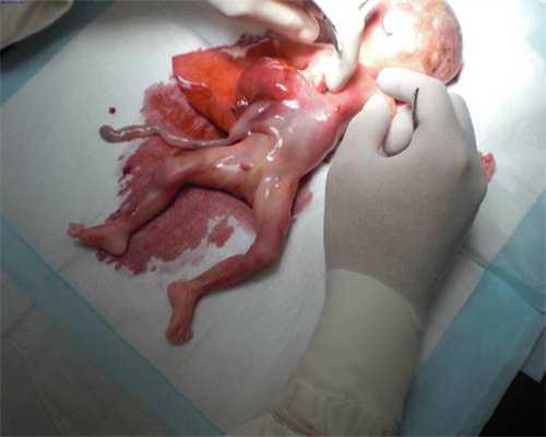 代生小孩是谁的-胚胎代孕的风险