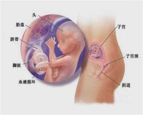 助孕代招怀孕-2020代孕合法吗剖腹产剖宫产的四个要点 