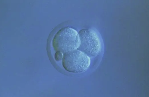 做试管取卵视频,试管婴儿取卵视频全过程 精子活力低下的原因有？